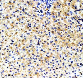 IHC staining of FFPE Zebrafish liver tissue with Ube2n antibody. HIER: boil tissue sections in pH8 E