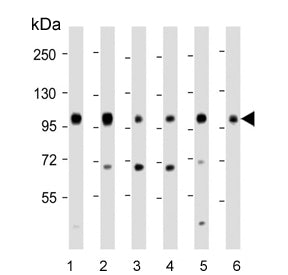 Western blot testing of 1) human 293T, 2) human A431, 3) mouse C2C12, 4) rat C6, 5) human HeLa and 6