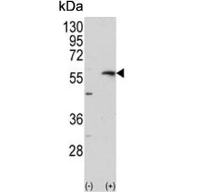 Collagenase 3 Antibody / MMP13