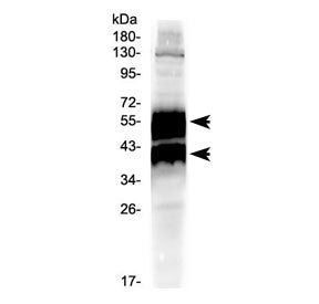 Western blot testing of human HeLa cell lysate with uPA Receptor antibody at 0.5ug/ml. Predicted mol