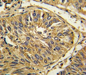 Fibroblast growth factor receptor 2 Antibody (FGFR2)