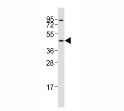 CCR1 Antibody