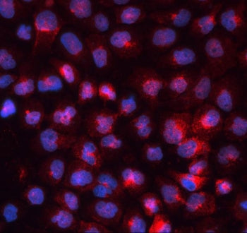 Immunofluorescent staining of FFPE human A431 cells with Transferrin Receptor antibody (red) and DAP