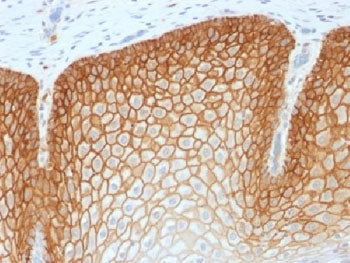 IHC testing of FFPE human tonsil with recombinant CD44v4 antibody (clone CD44v4/1700). Required HIER