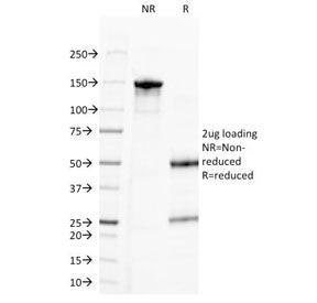 SDS-PAGE Analysis of Purified, BSA-Free Progesterone Antibody (clone 6-5E-3F). Confirmation of Integ