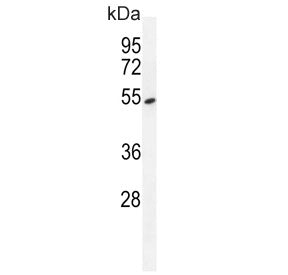 TDP2 Antibody / ETS1 associated protein II