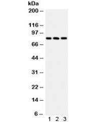 Western blot testing of human 1) HeLa, 2) A549 and 3) COLO320 lysate with Calcineurin A antibody. Pr