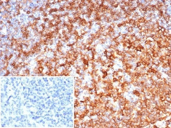 IHC staining of FFPE human tonsil tissue with HLA-DR antibody (clone rHLA-DRB/7198). Inset: PBS used