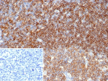 IHC staining of FFPE human tonsil tissue with CD45 antibody (clone PTPRC/6862). Inset: PBS used in p