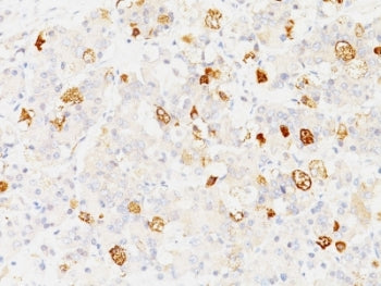 IHC: Formalin-fixed, paraffin-embedded human pituitary stained with FSH-beta antibody (clone SPM107)
