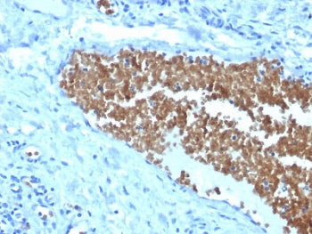 IHC staining of FFPE human tonsil with Spectrin alpha 1 antibody (clone SPTA1/1832). Required HIER: 