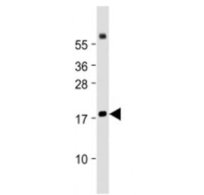 Western blot testing of Chemerin antibody at 1:2000 dilution + human lung lysate. Predicted molecula