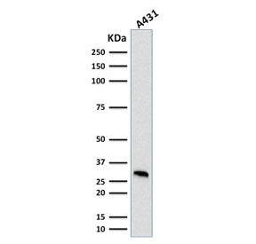 Western blot testing of human A431 cell lysate with MTAP antibody (clone MTAP/1813). Expected molecu