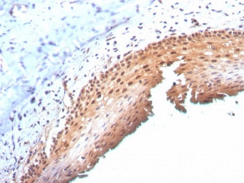 p16INK4a Antibody / CDKN2A