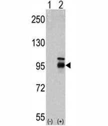 Western blot analysis of FGFR4 antibody and 293 cell lysate either nontransfected (Lane 1) or transi