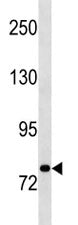 STAT3 Antibody