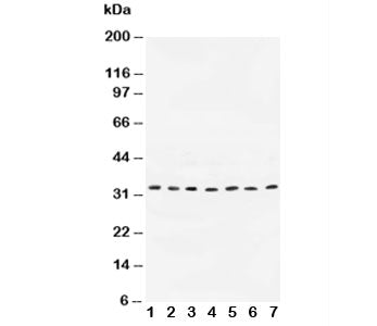 Western blot testing of Cyclin D1 antibody and Lane 1: rat testis; 2: human placenta; 3: rat brain; 