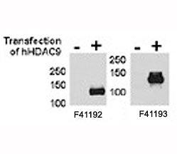 HDAC9 antibody <a href=../tds/hdac9-antibody-f41192>NSJ# F41192</a> and NSJ# F41193 were tested by W