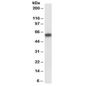 Western blot testing of human kidney lysate with P2rx4 antibody at 1ug/ml. Expected molecular weight