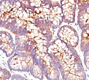 CEA Antibody / Carcinoembryonic Antigen