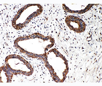 SMAD2 Antibody