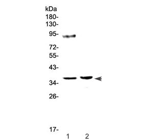 Western blot testing of 1) rat testis and 2) rat ovary tissue lysate with Tbp antibody at 0.5ug/ml. 