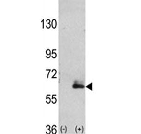 Western blot analysis of anti-MAP2 antibody and 293 cell lysate (2 ug/lane) either nontransfected (L