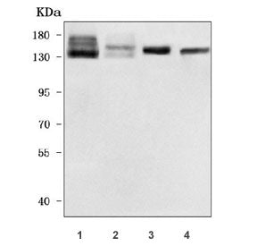 Western blot testing of 1) human SH-SY5Y, 2) human RT4, 3) rat brain and 4) mouse brain tissue lysat