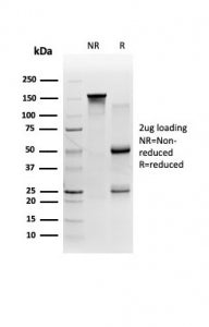 SDS-PAGE analysis of purified, BSA-free 58K Golgi protein antibody (clone FTCD/357) as confirmation of integrity and purity.