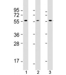 Western blot testing of 1) human MCF7, 2) human Jurkat and 3) rat PC-12 cell lysate with AKT2 antibo