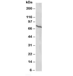 Western blot testing of Estrogen receptor antibody and MCF-7 lysate (human breast cancer line). Pred