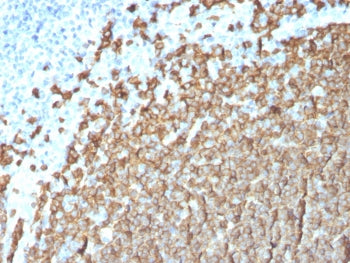 IHC staining of FFPE human tonsil tissue with CD20 antibody (clone MS4A1/3411). HIER: boil tissue se