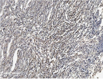 SHANK3 Antibody