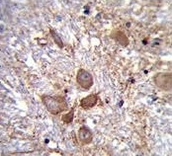 IHC testing of FFPE human brain tissue with SPECC1L antibody. HIER: steam section in pH6 citrate buf