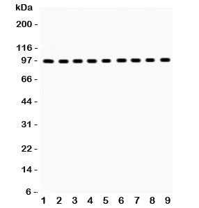 Western blot testing of GR antibody and Lane 1: rat liver; 2: (r) brain; 3: (r) spleen; 4: human pla