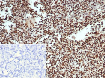 IHC staining of FFPE human lymph node tissue with XRCC5 / Ku86 / Ku80 antibody (clone XRCC5/7312). I