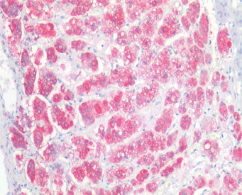 IHC testing of FFPE human adrenal gland tissue with NCAM antibody at 5ug/ml. Required HIER: steamed 