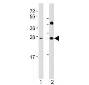 Western blot testing of DKK2 antibody at 1:2000: Lane 1) human brain and 2) mouse heart lysate. Expe