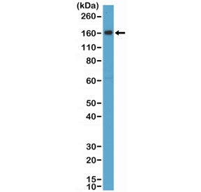 Western blot testing of human placental tissue lysate with recombinant CD163 antibody at 1:2000 dilu
