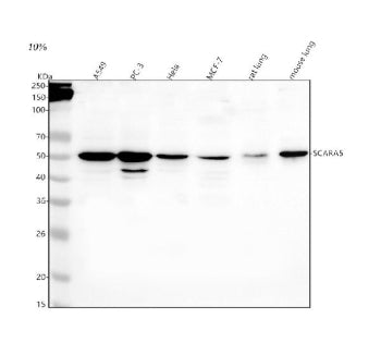 Western blot analysis of SCARA5 using anti-SCARA5 antibody. Lane 1: human whole cell lysates, Lane 2