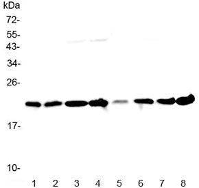 Western blot testing of human 1) HeLa, 2) placenta, 3) MCF7, 4) COLO320, 5) 22RV1, 6) HepG2, 7) A431