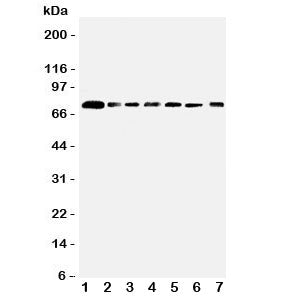 Western blot testing of SPARCL1 antibody and Lane 1: rat lung; 2: mouse lung; and human samples 3: P