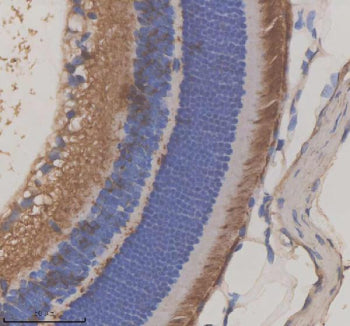 Immunohistochemical staining of GRK1 using anti-GRK1 antibody. GRK1 was detected in a paraffin-embed