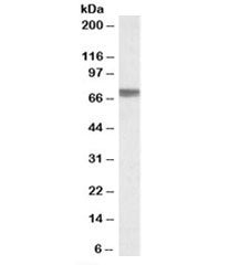 TGFBI Antibody