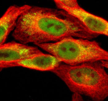 Immunofluorescent staining of SESN3 using anti-SESN3 antibody (green) and anti-Beta Tubulin antibody