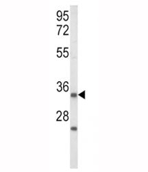 Western blot analysis of IGFBP2 antibody and human Jurkat cell lysate. Predicted/observed molecular 