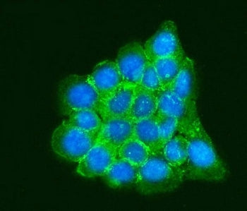Immunofluorescent staining of FFPE human A431 cells with RPLP0 antibody (green) and DAPI nuclear sta
