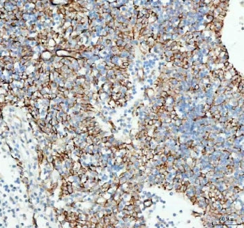 IHC staining of FFPE human spleen tissue with TACI antibody. HIER: boil tissue sections in pH8 EDTA 