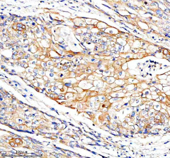 Immunohistochemical staining of FUNDC1 using anti-FUNDC1 antibody. FUNDC1 was detected in a paraffin