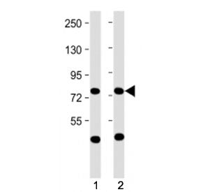 Western blot testing of MPL antibody at 1:2000: Lane 1) human Daudi and 2) HepG2 cell lysate. Predic
